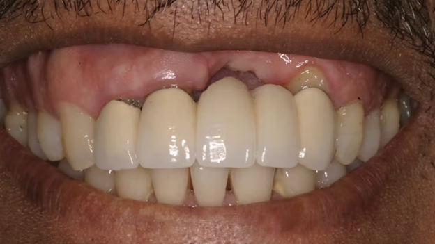 Smiles Elevated | Schick 33 Digital Radiography, Periodontal Treatment and Laser Gum Treatment