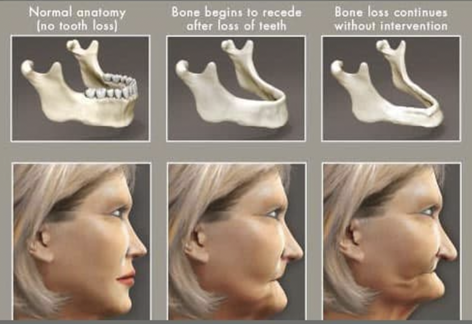 Smiles Elevated | Traditional Dentures Full amp Partial , Growth amp Development Monitoring and Teeth Whitening