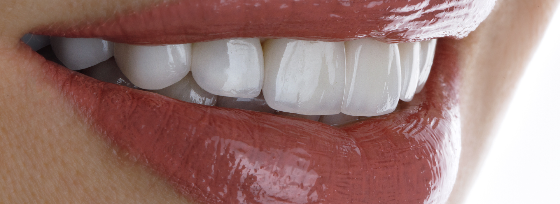 Smiles Elevated | Botox reg , Impressionless Dentistry and Sleep Apnea Appliances