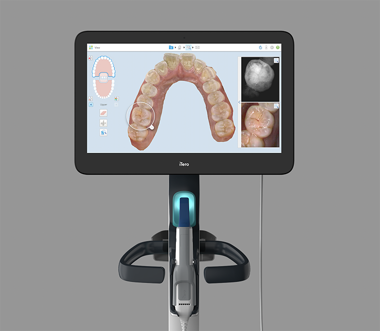 Smiles Elevated | Implants, Fillings and Impressionless Dentistry